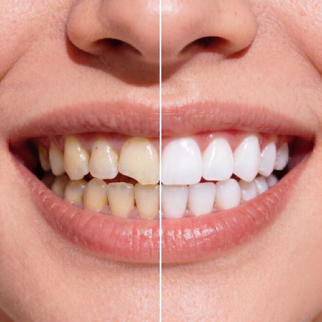 WellaSmile image